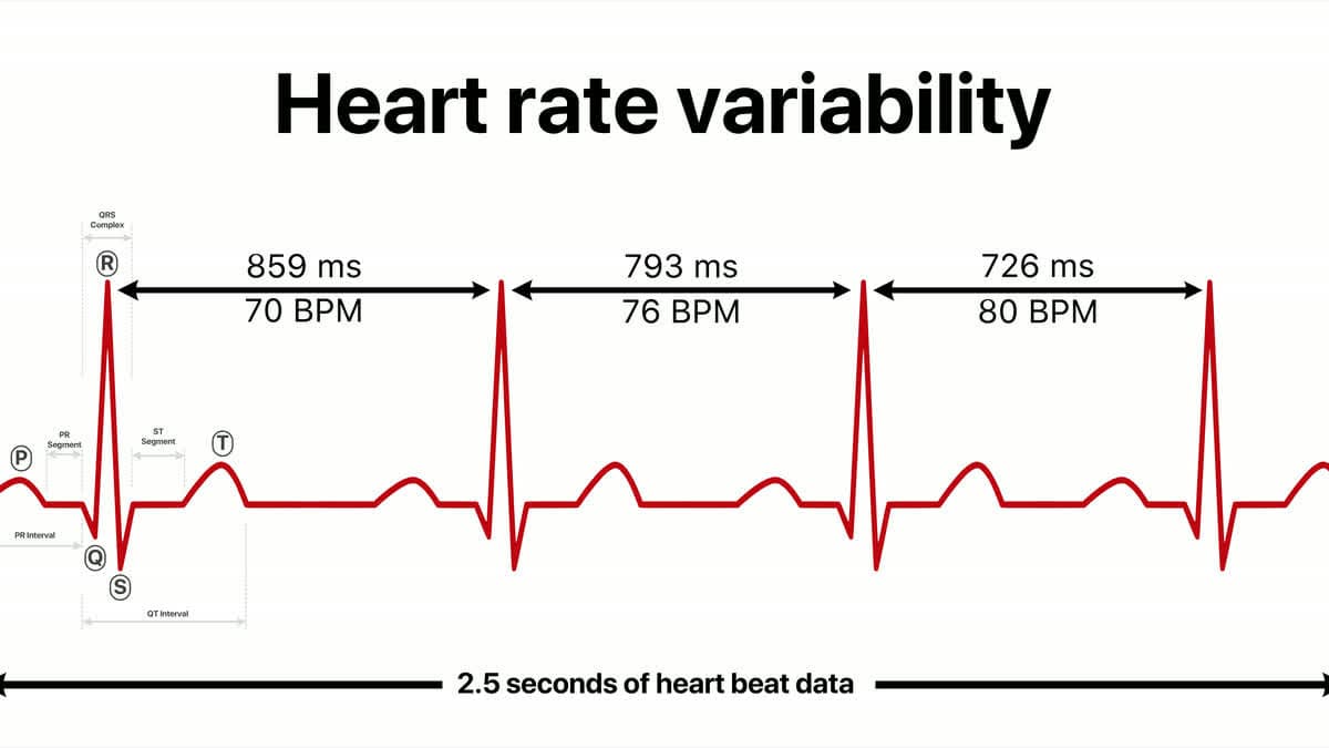 Kalp atışları arasındaki milisaniye farkını gösteren EKG dalga formu şeması (P-QRS-T dalgaları, RR aralıkları, ms ve BPM