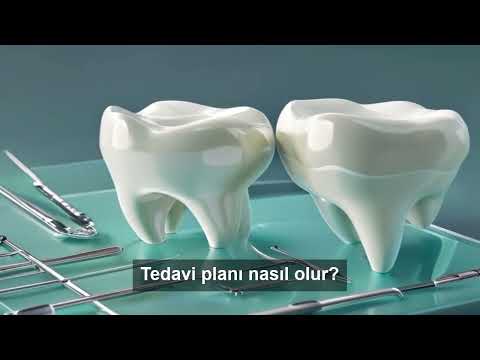 Diş implantı nedir, kimlere uygundur? | 2026 rehberi